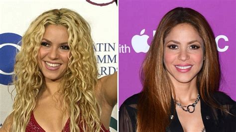 shakira breast implants|Shakira undergoes cosmetic surgery